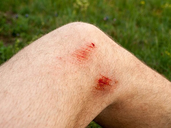 Nằm mơ thấy chảy máu chân có phải điềm gở?